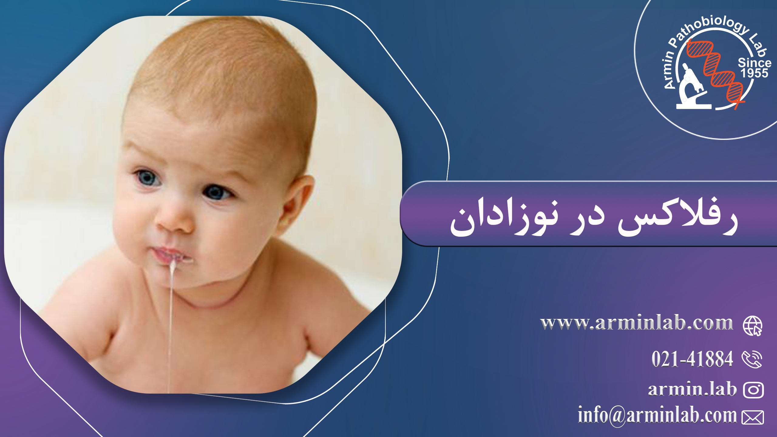 رفلاکس در نوزادان