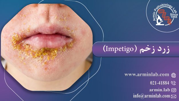 زرد زخم (Impetigo)