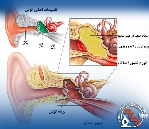 علل عفونت گوش و گوش درد در دوران بارداری