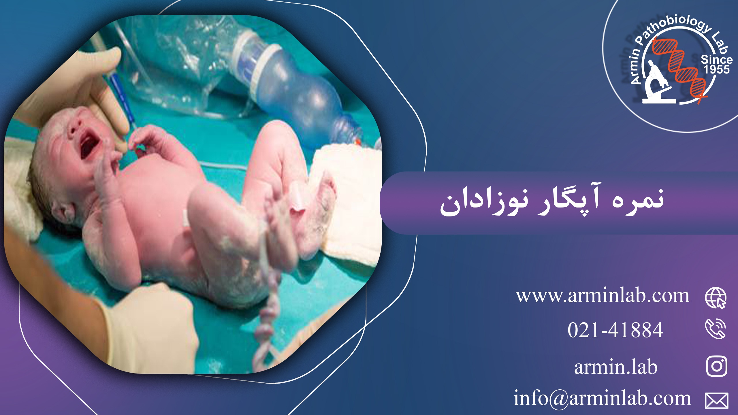 نمره آپگار نوزادان