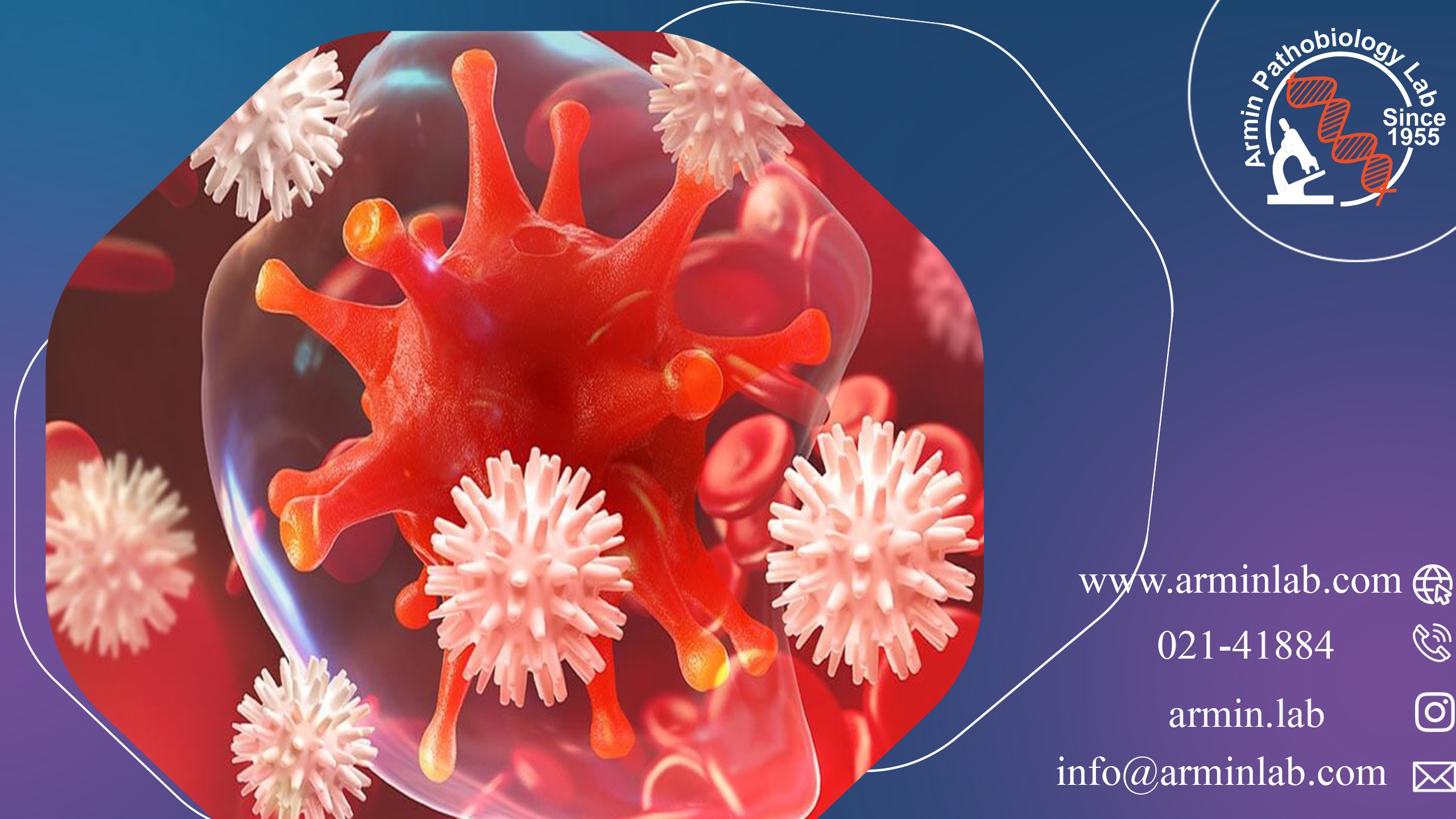 هموگلوبینوری حمله ای شبانه (PNH)_ آزمایشگاه آرمین