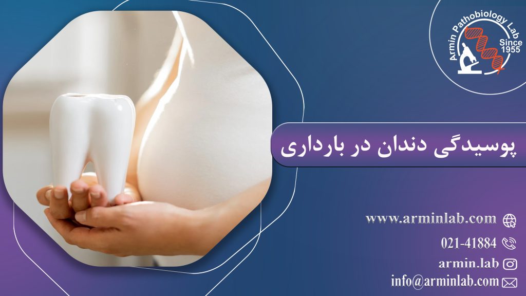 پوسیدگی دندان در بارداری