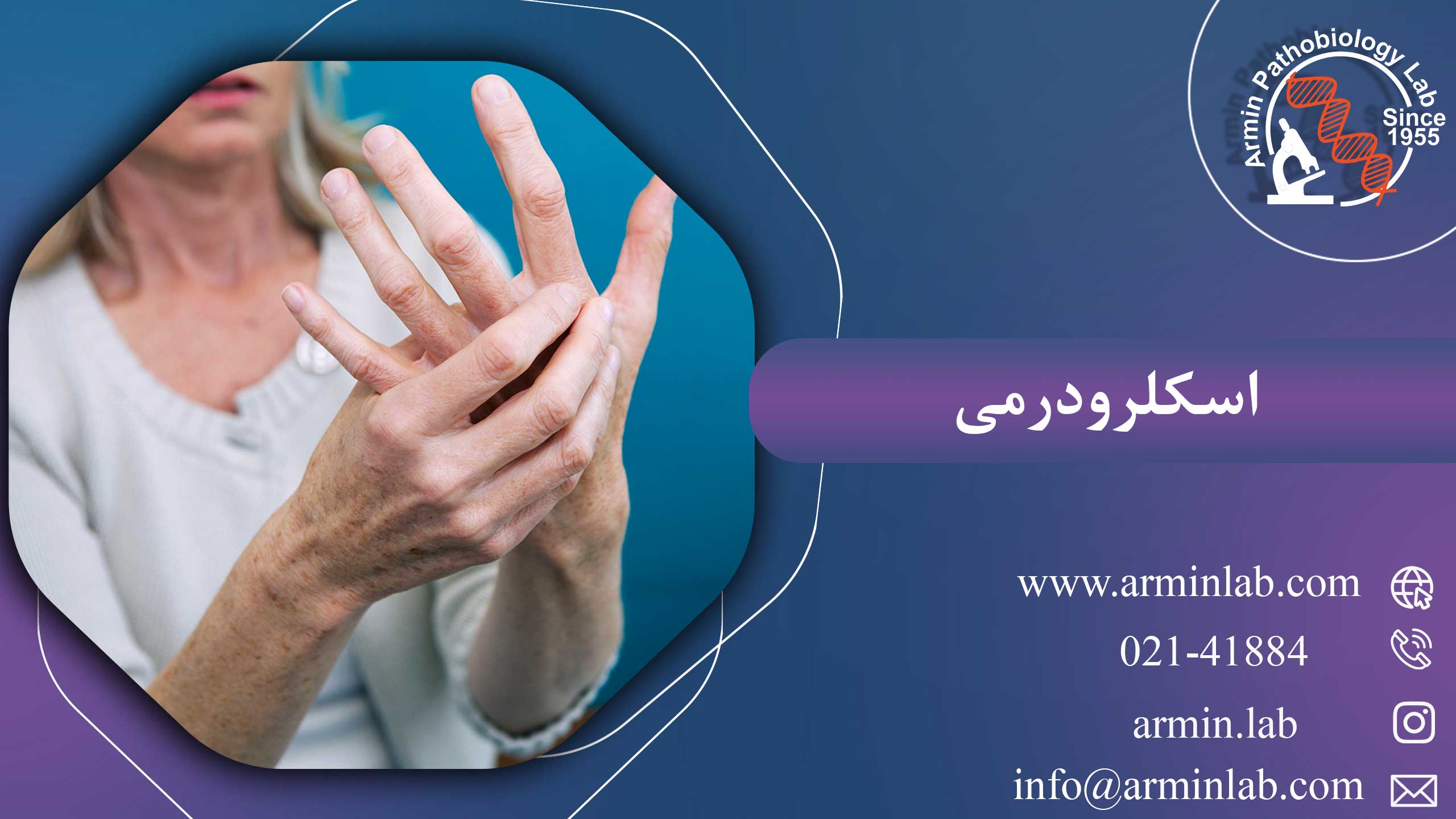 اسکلرودرمیarminlab1 اسکلرودرمی