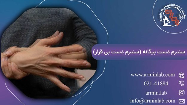 سندرم دست بیگانه (سندرم دست بی قرار)