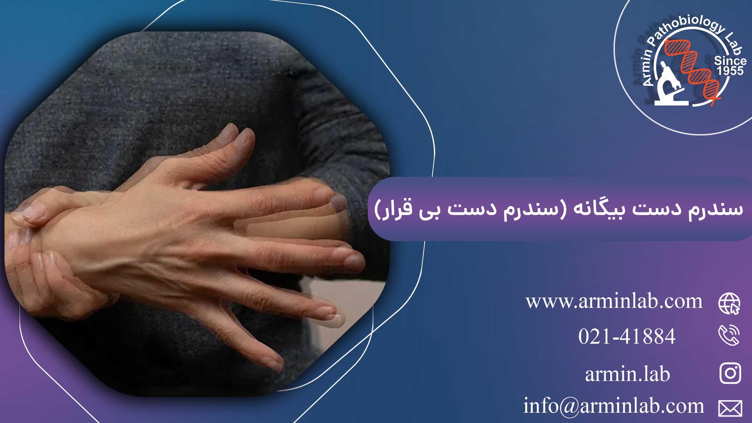 سندرم-دست-بیگانه-(سندرم-دست-بی-قرار)-arminlab1 سندرم دست بیگانه (سندرم دست بی قرار)