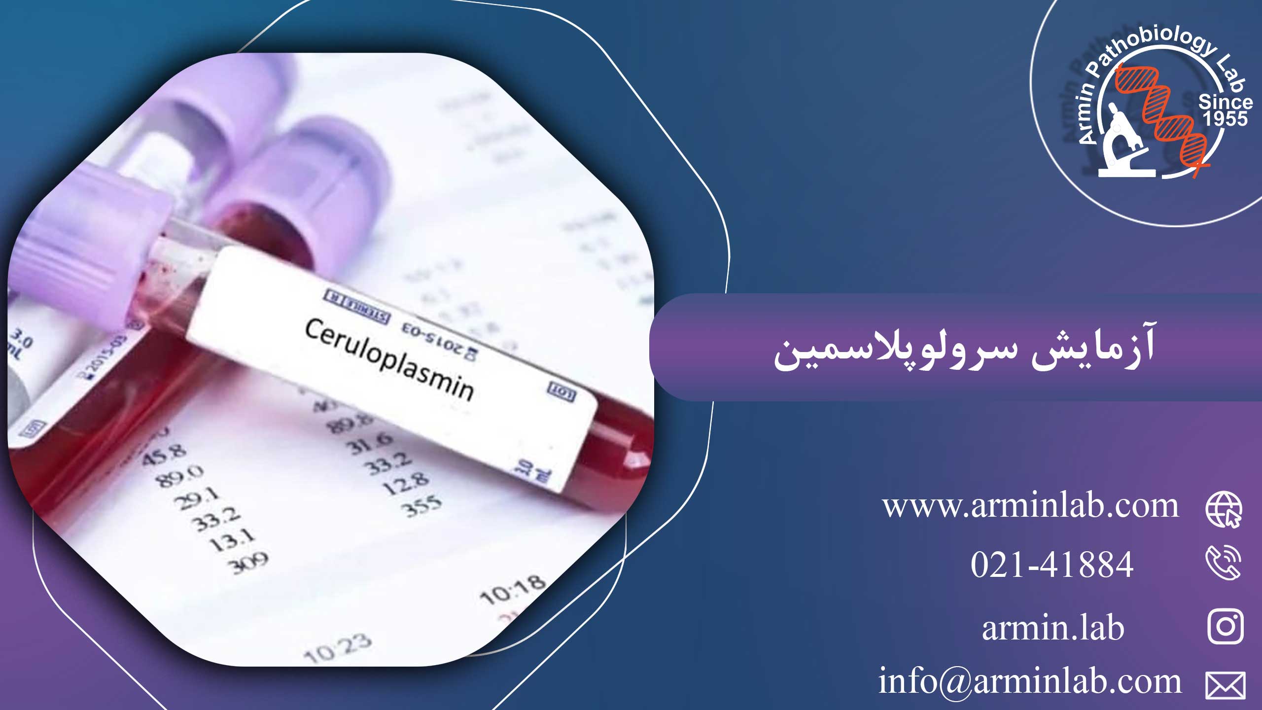 آزمایش سرولوپلاسمین