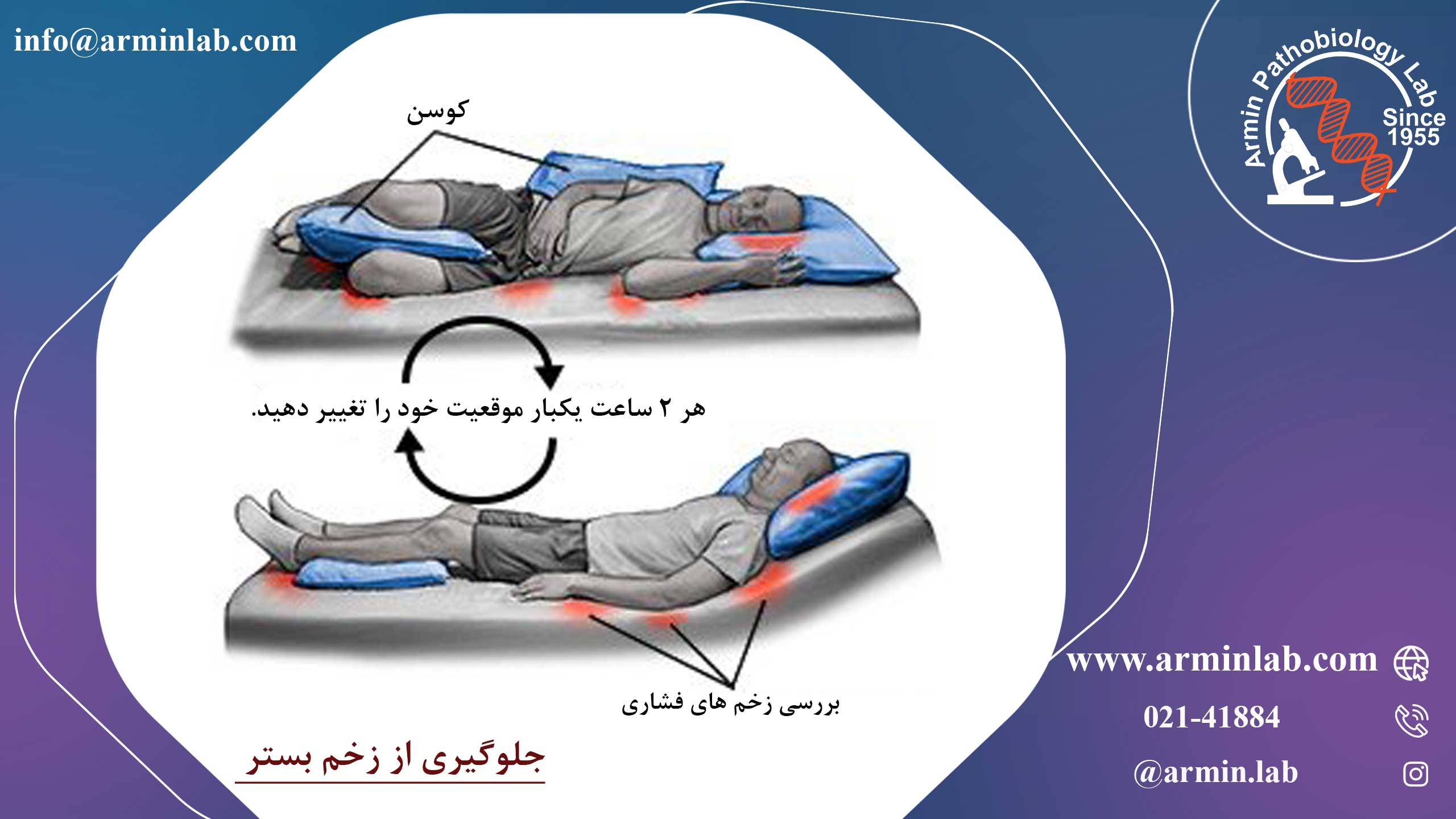 زخم بستر (زخم های فشاری)