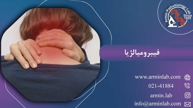 فیبرومیالژیا