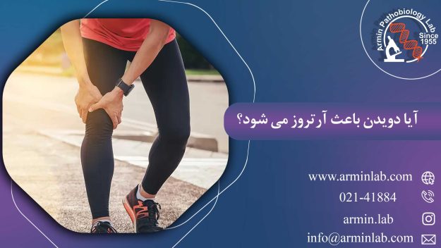 آیا دویدن باعث آرتروز می شود؟