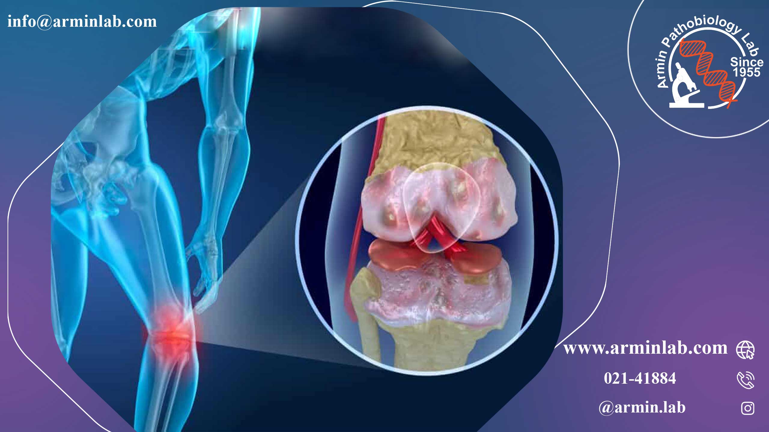 آیا دویدن باعث آرتروز می شود؟