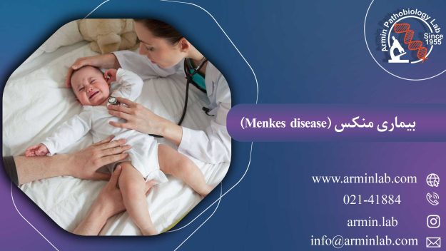 بیماری منکس ( Menkes disease )