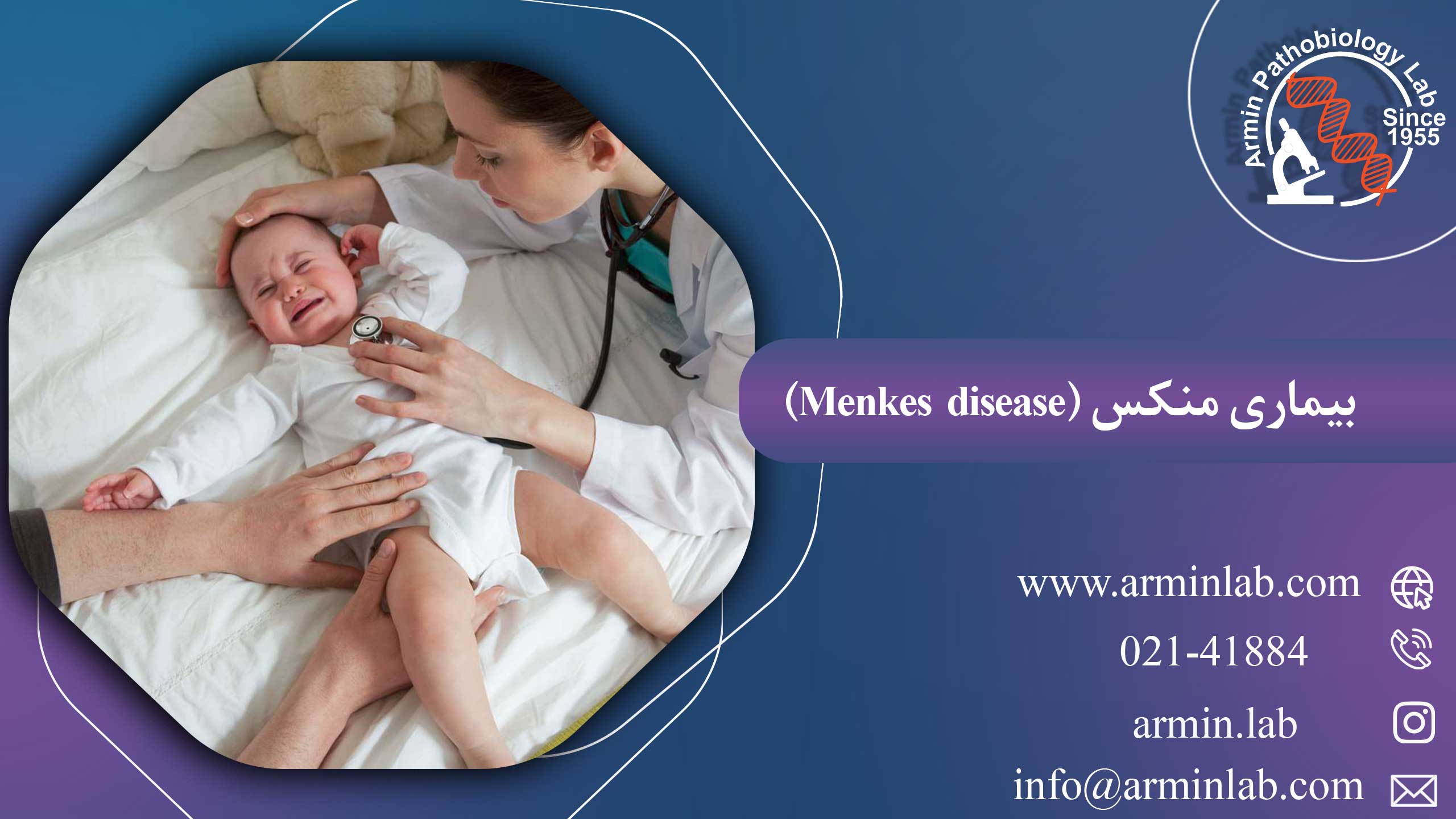 بیماری منکس ( Menkes disease )