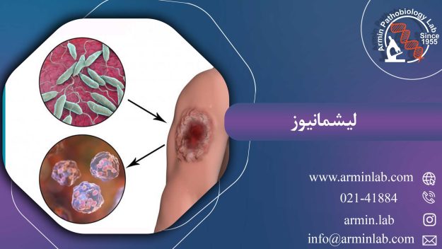 لیشمانیوز