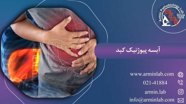 آبسه پیوژنیک کبد