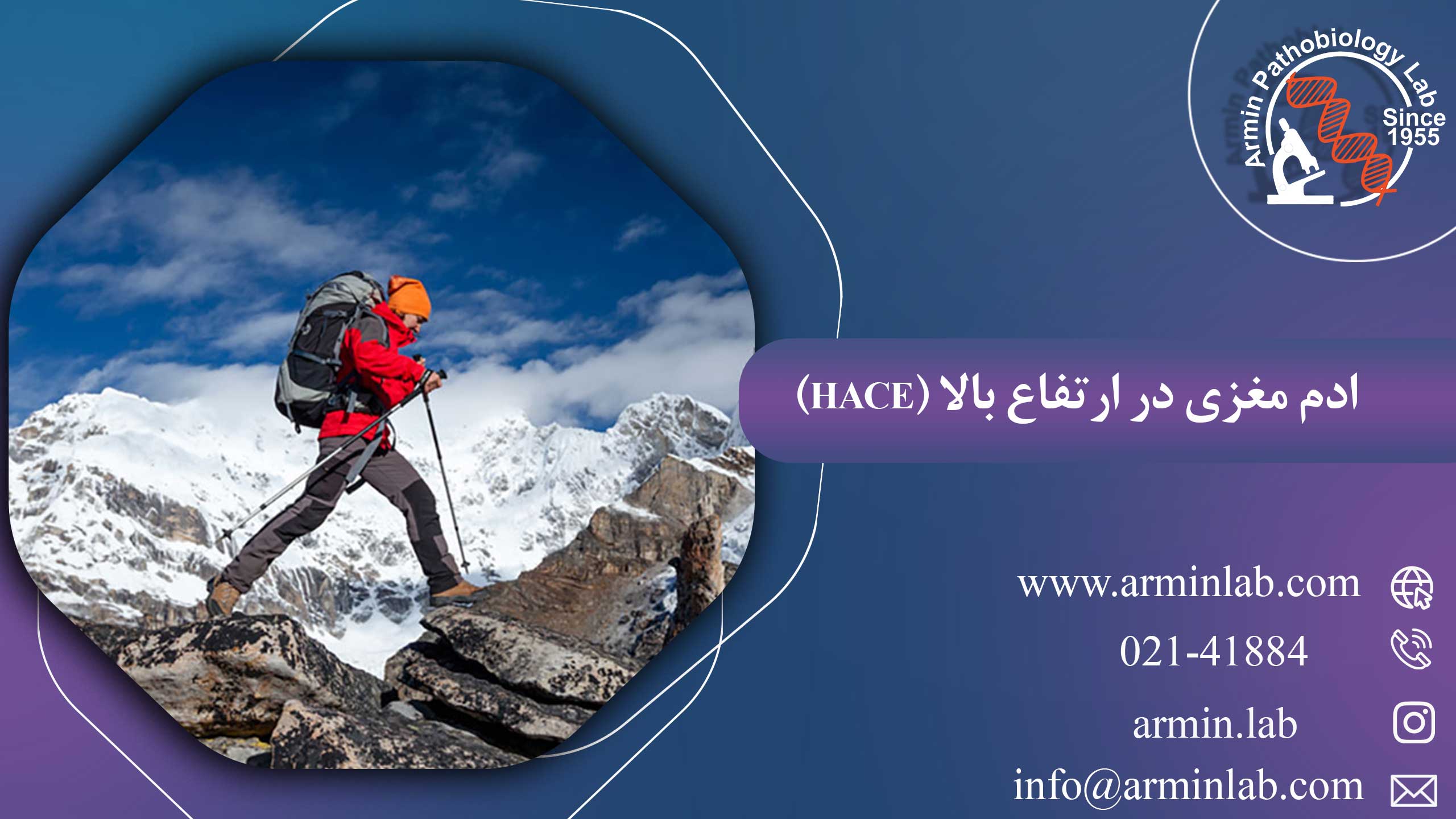 ادم مغزی در ارتفاع بالا (HACE)