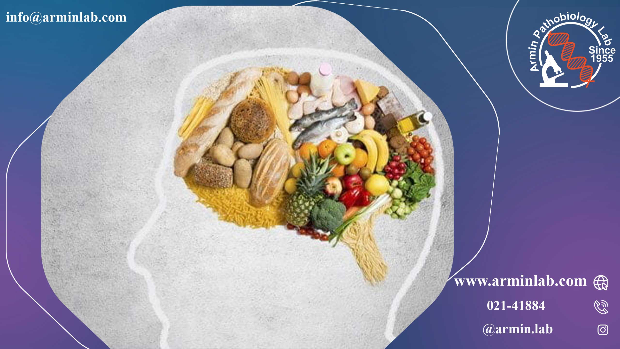 رابطه بین رژیم‌ غذایی و بیماری آلزایمر