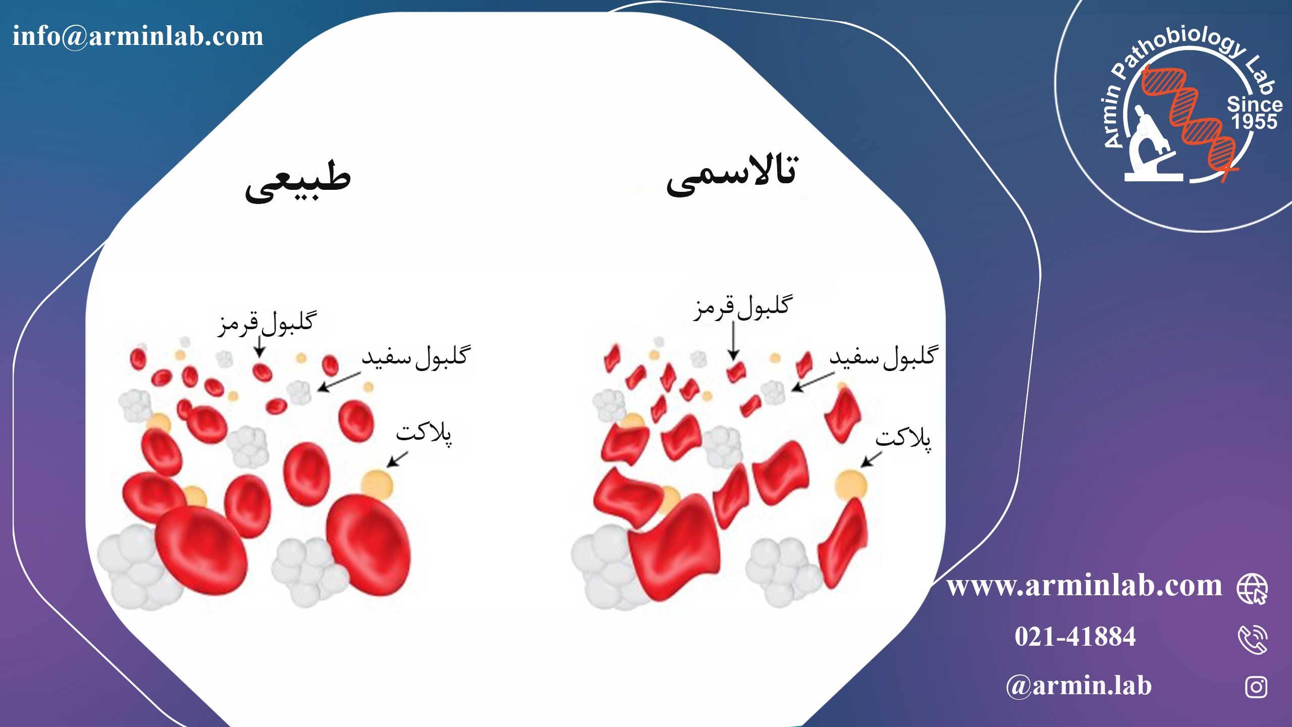 آزمایش ژنتیکی تالاسمی