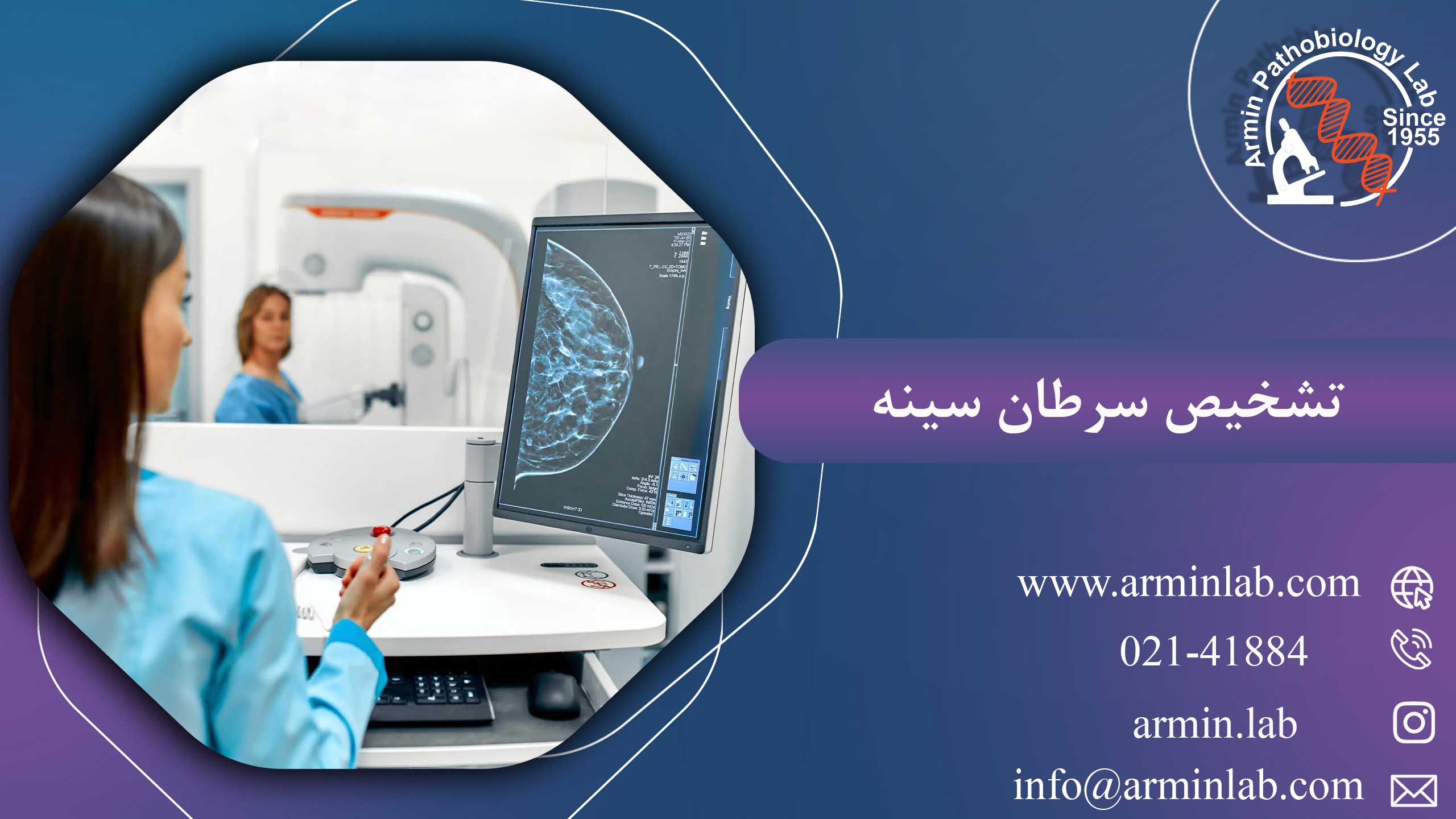 تشخیص سرطان سینه