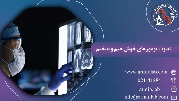 تفاوت تومورهای خوش خیم و بدخیم