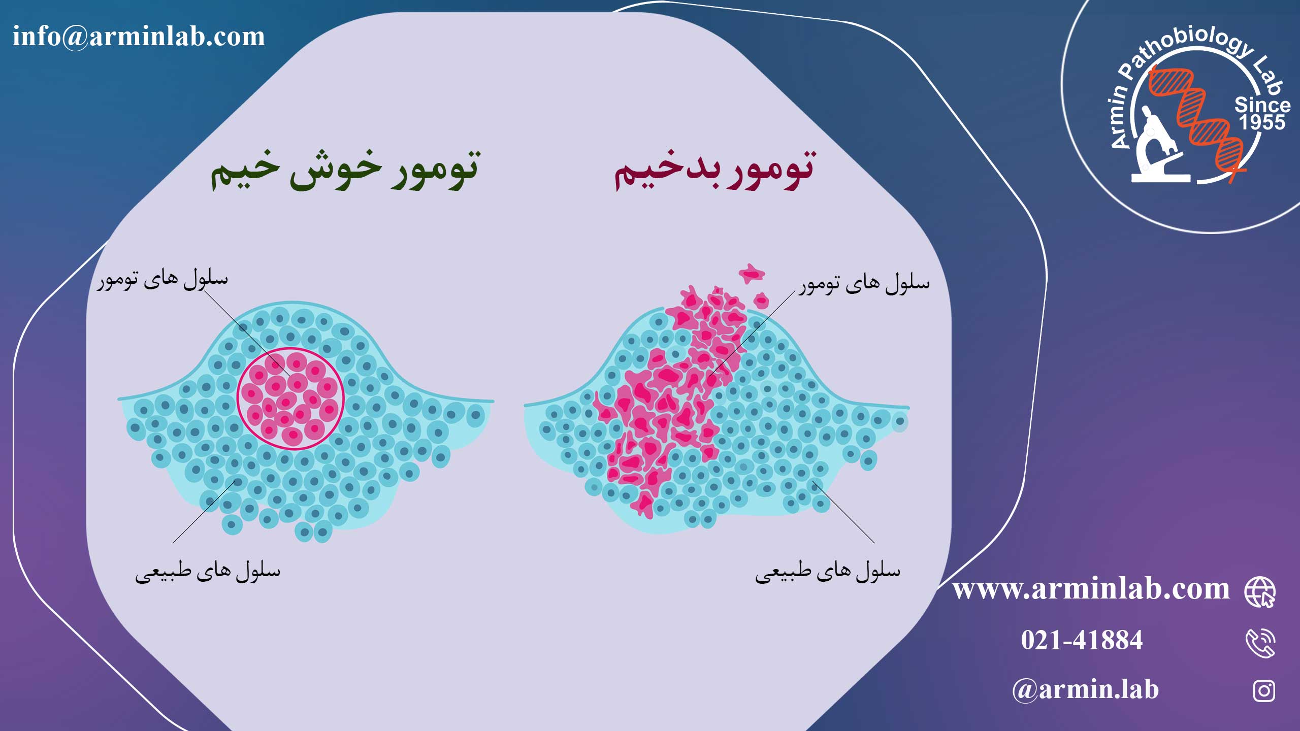تفاوت تومورهای خوش خیم و بدخیم