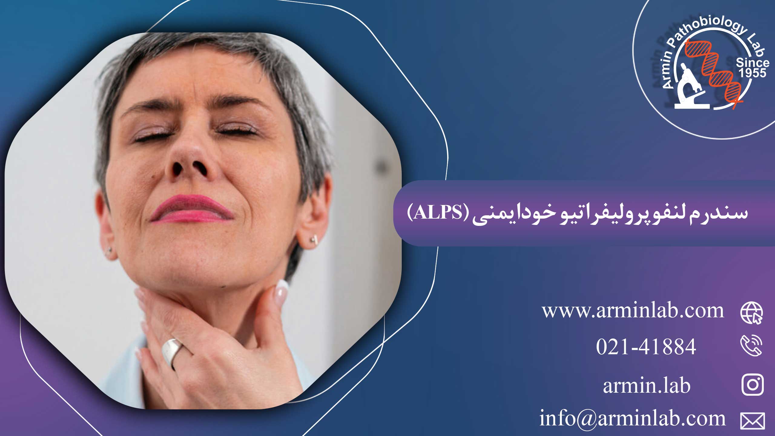سندرم-لنفوپرولیفراتیو-خودایمنی-(ALPS)arminlab سندرم لنفوپرولیفراتیو خودایمنی (ALPS)
