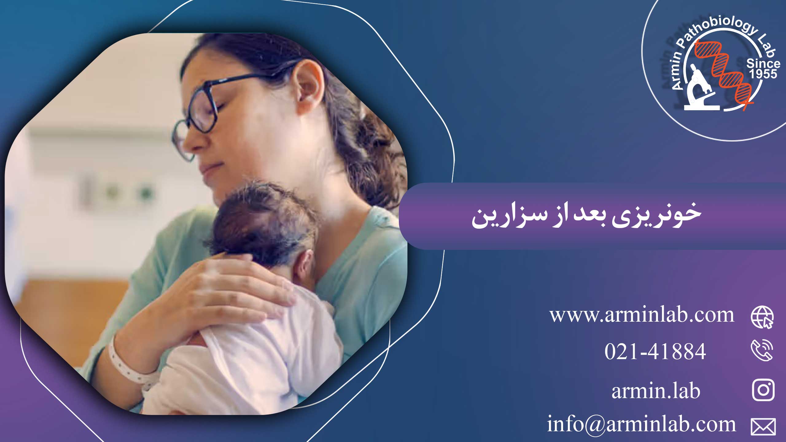 خونریزی بعد از سزارین