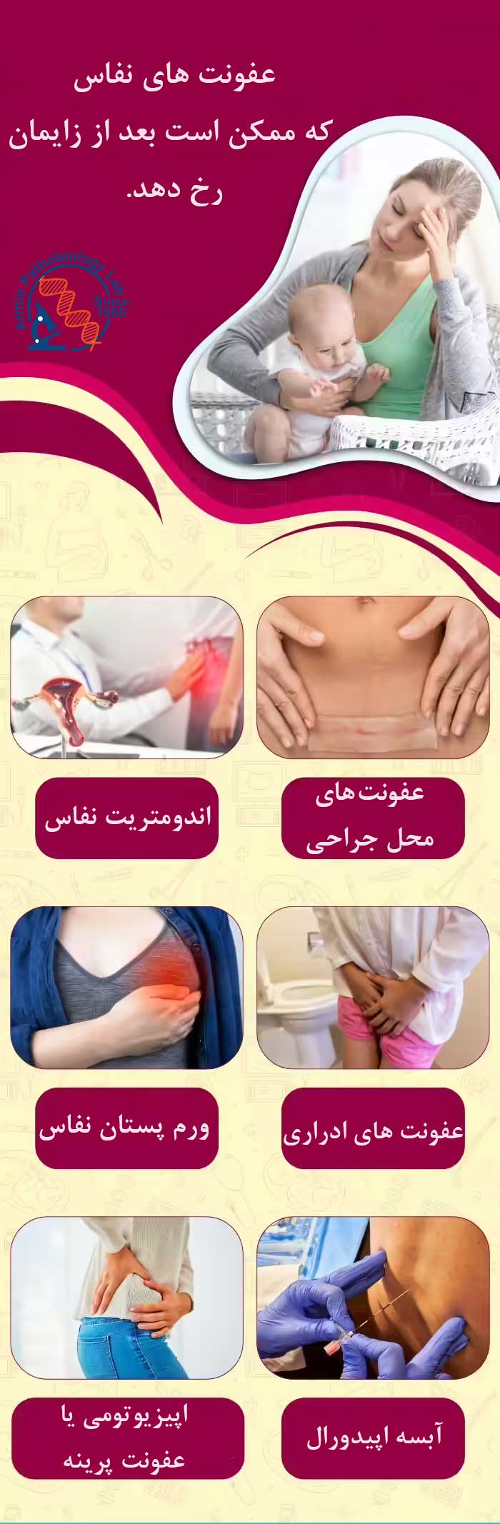 عفونت‌های نفاس