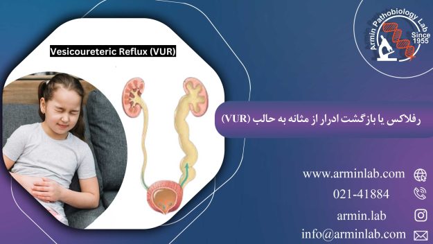 رفلاکس یا بازگشت ادرار از مثانه به حالب (VUR)