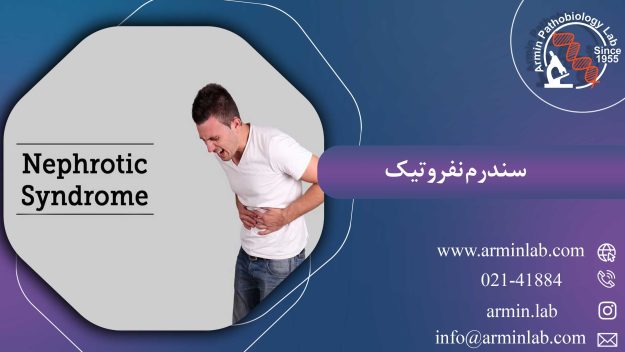سندرم نفروتیک