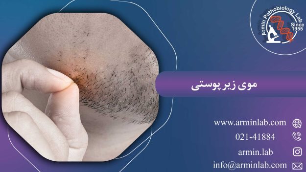 موی زیر پوستی