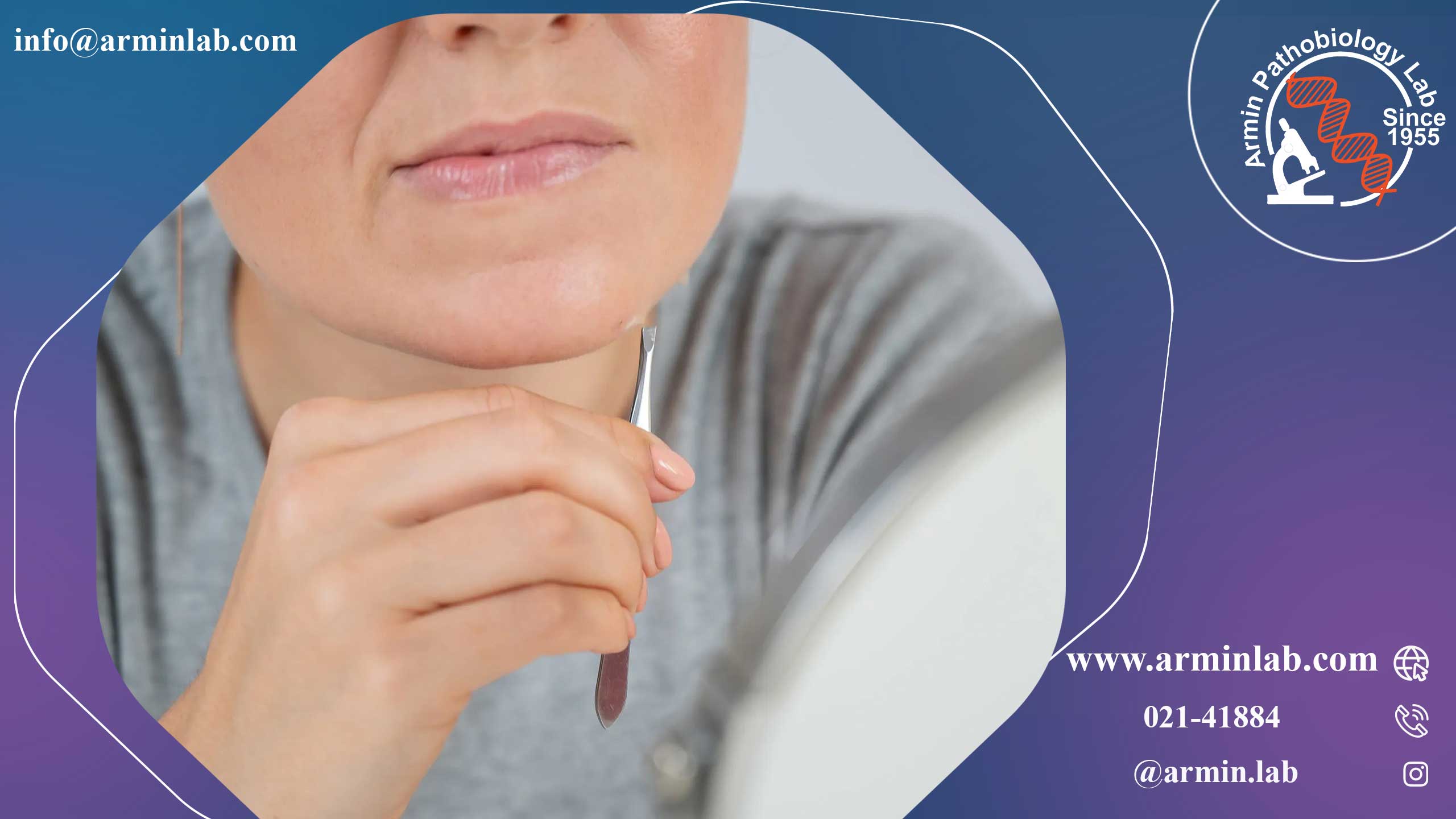 موی زیر پوستی