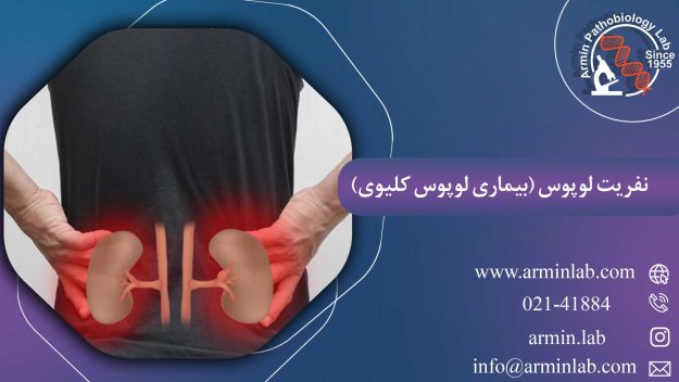 نفریت لوپوس (بیماری لوپوس کلیوی)