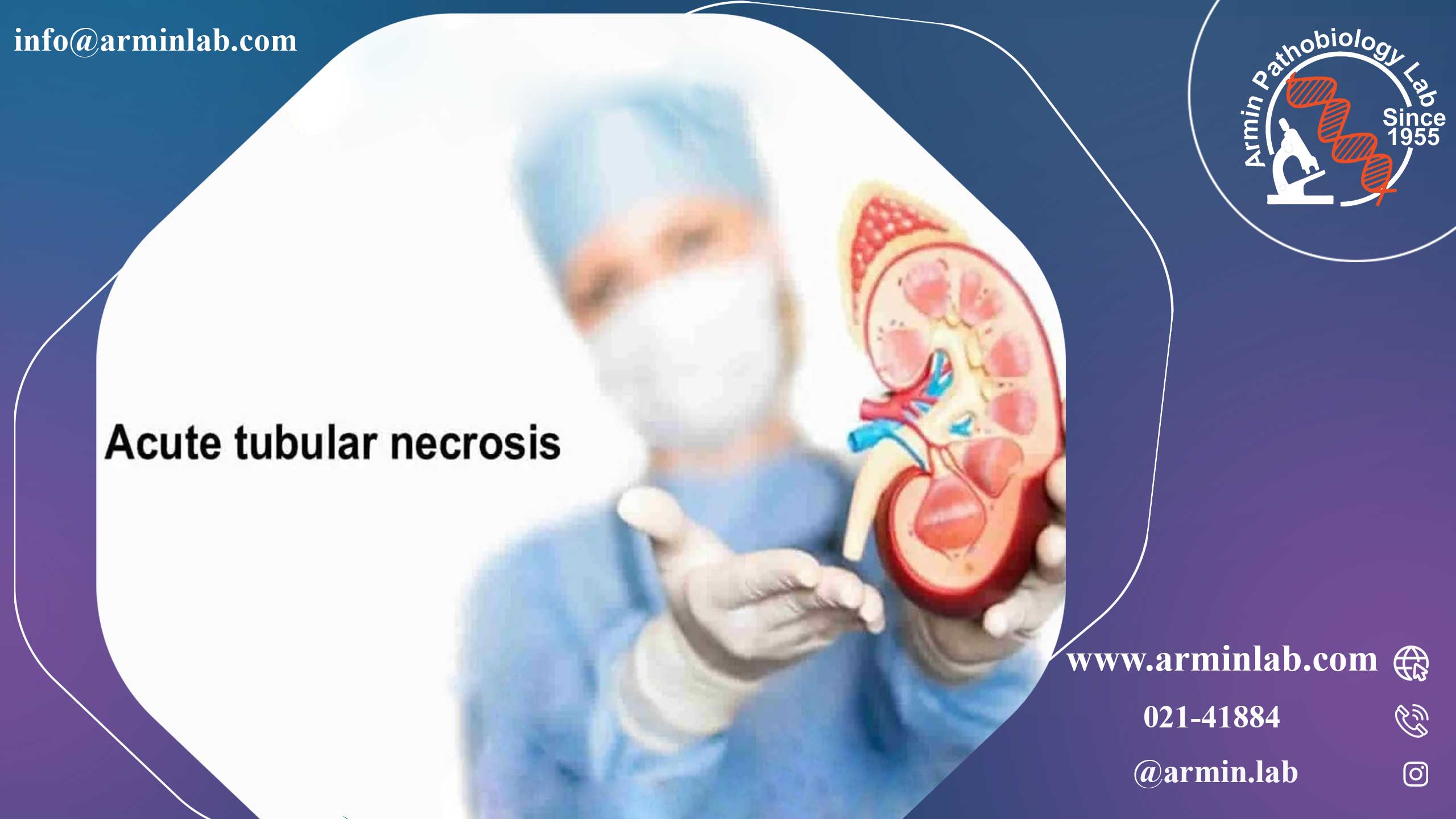 نکروز توبولار حاد کلیه