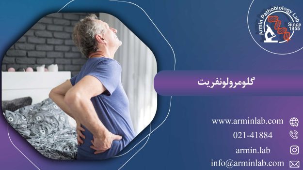 گلومرولونفریت