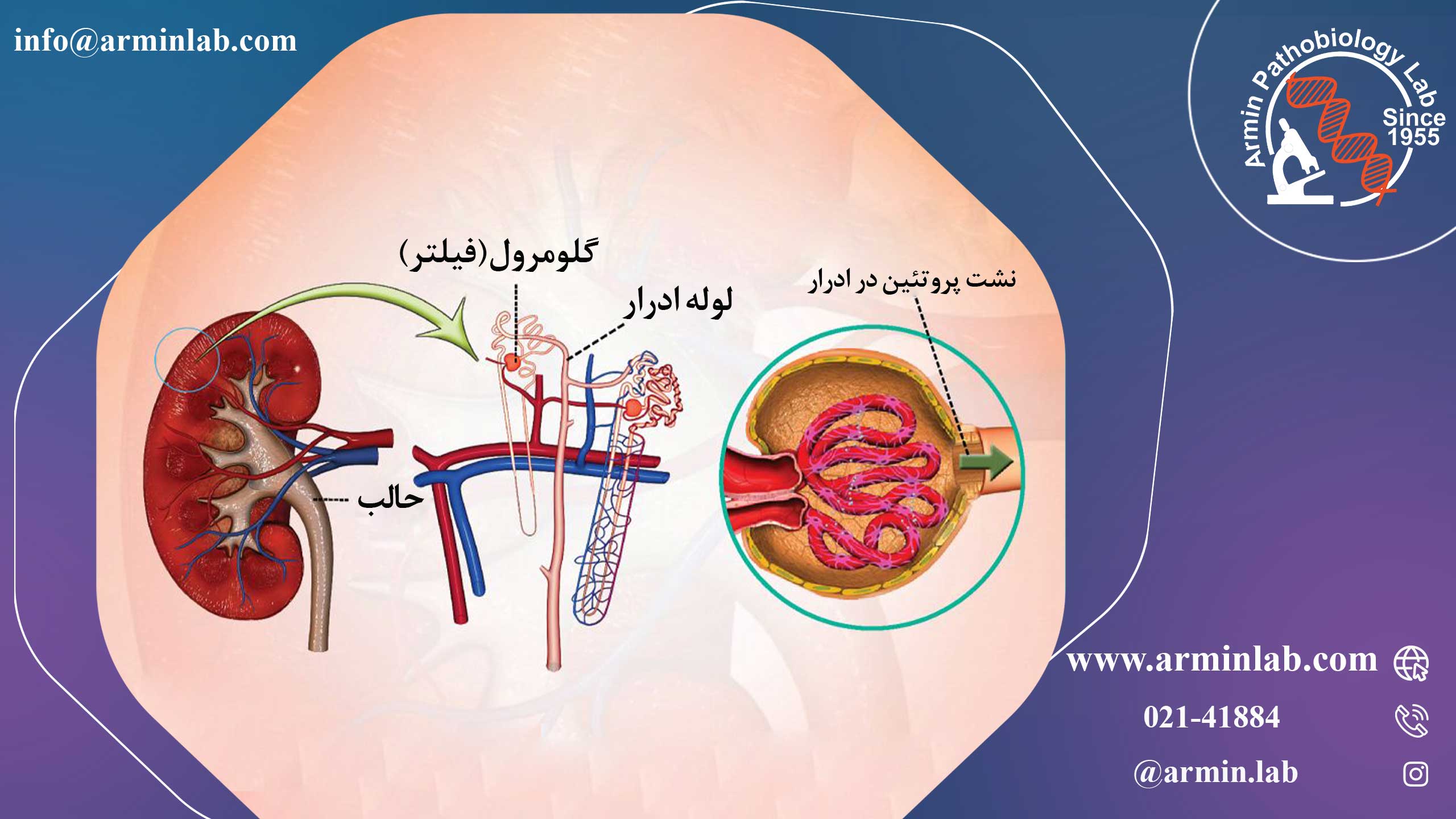 گلومرولونفریت