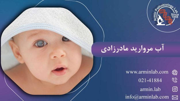 آب مروارید مادرزادی