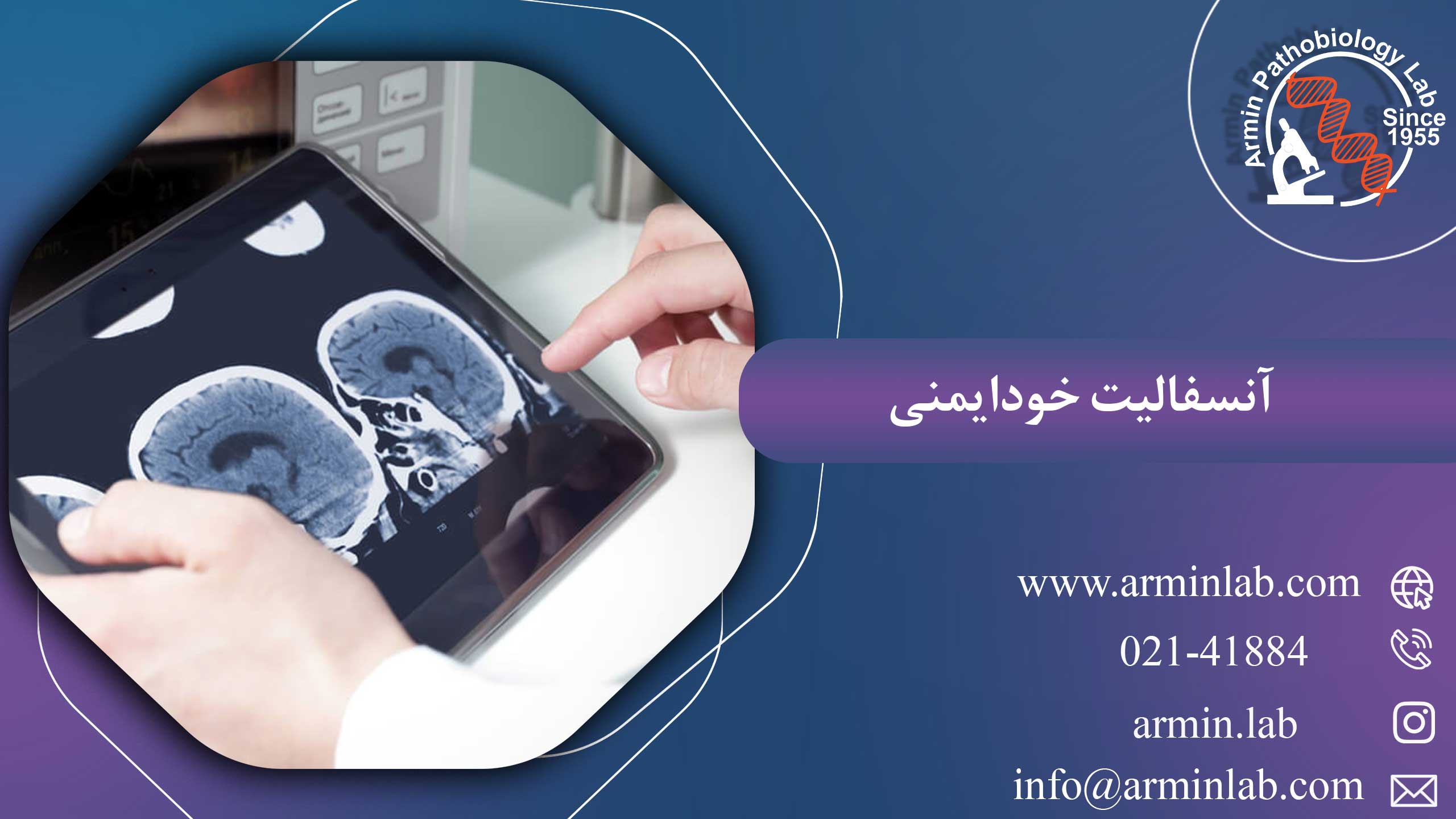 آنسفالیت خودایمنی