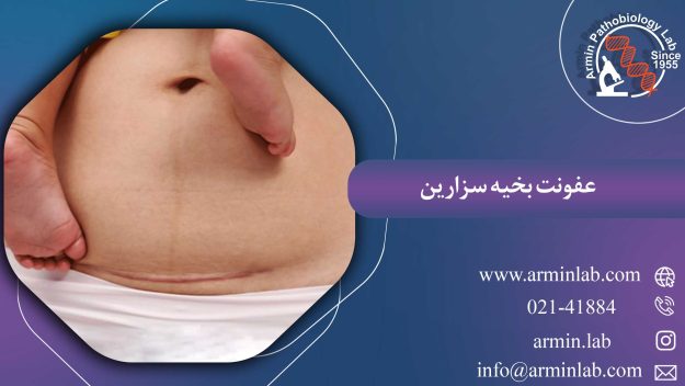 عفونت بخیه سزارین