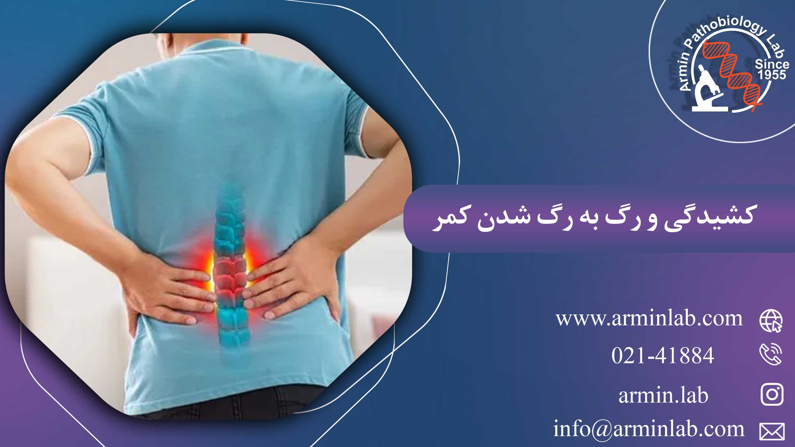 کشیدگی و رگ به رگ شدن کمر