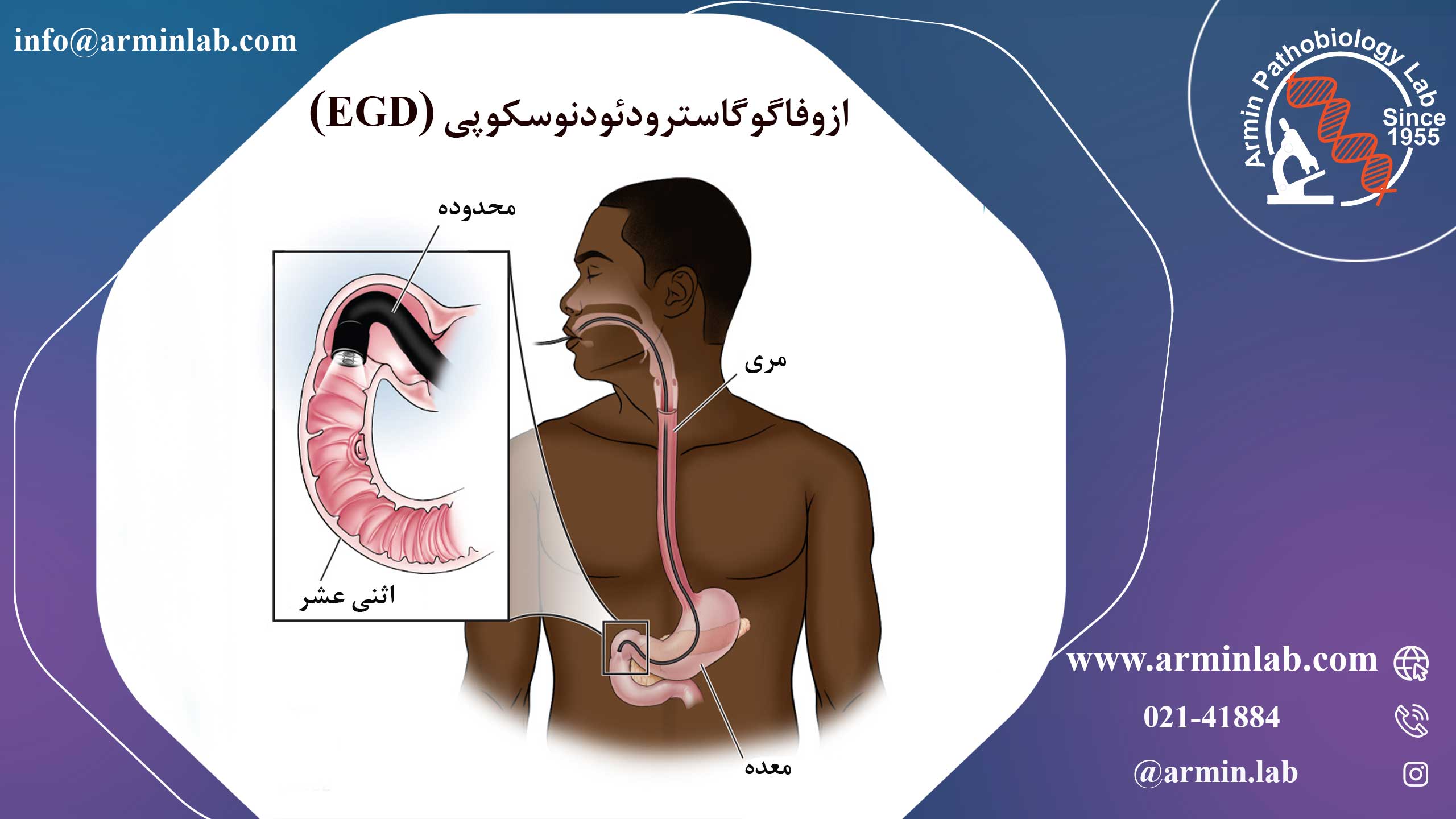آندوسکوپی فوقانی 