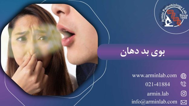 بوی بد دهان