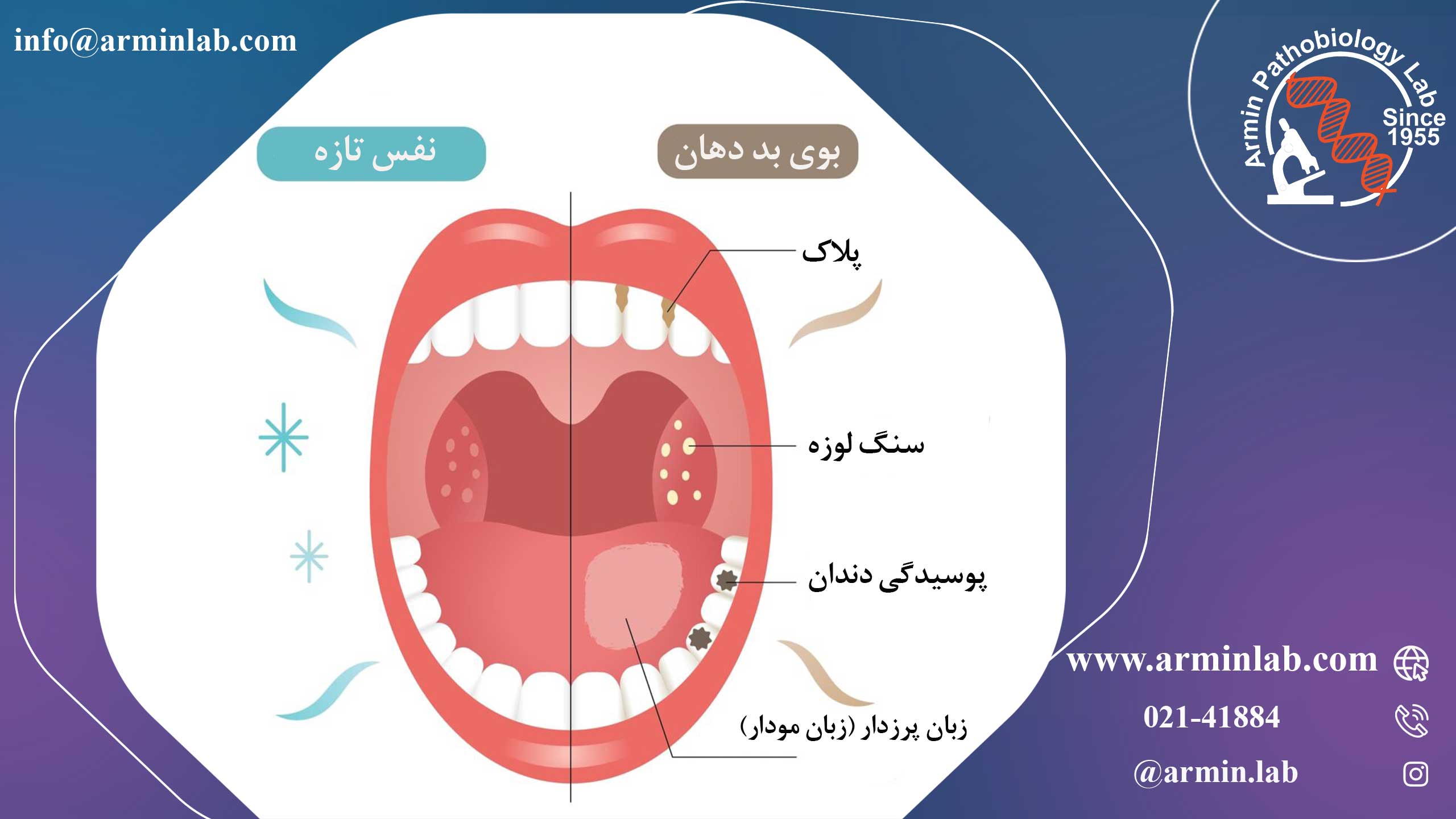 بوی بد دهان