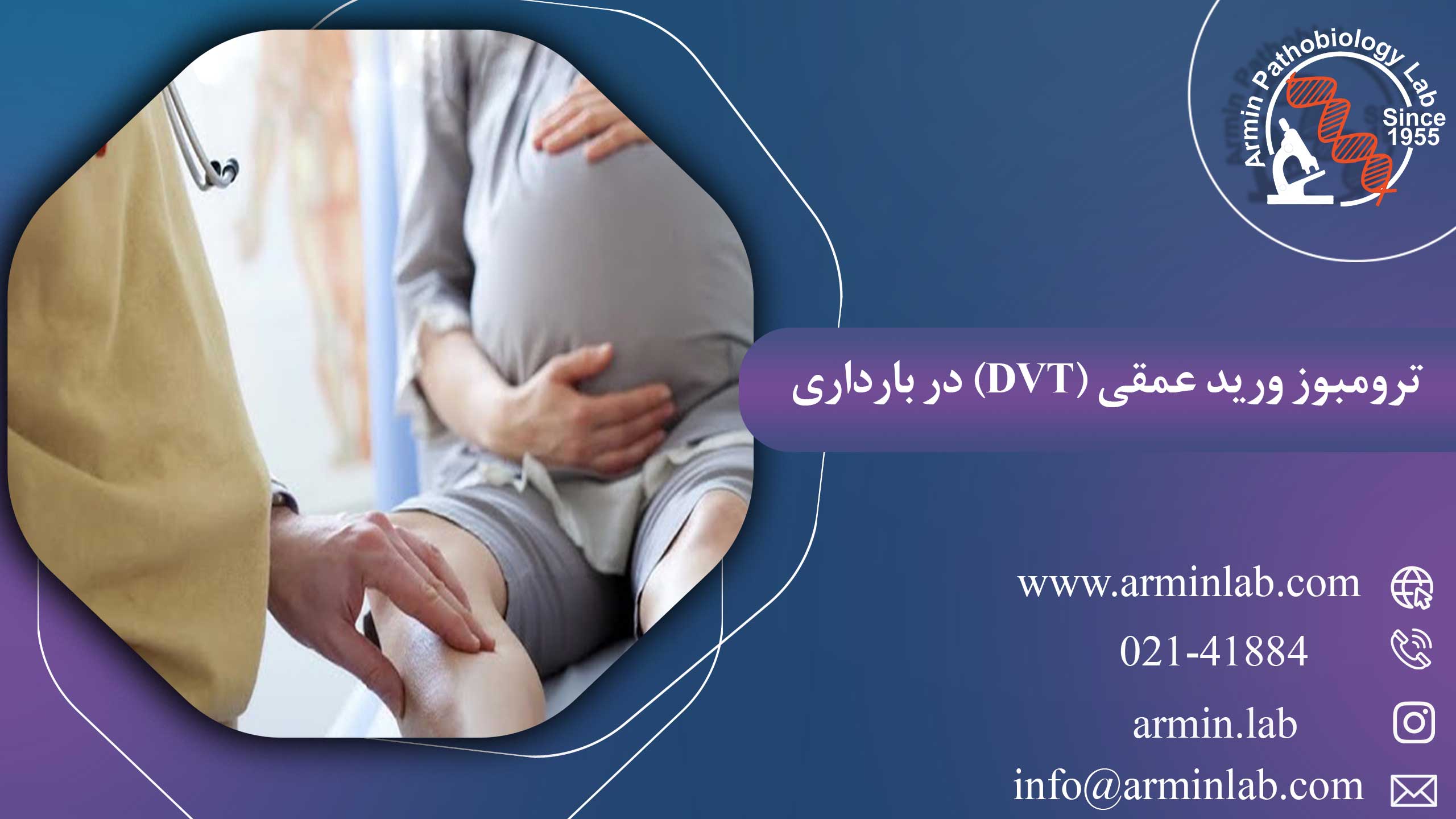 ترومبوز ورید عمقی (DVT) در بارداری