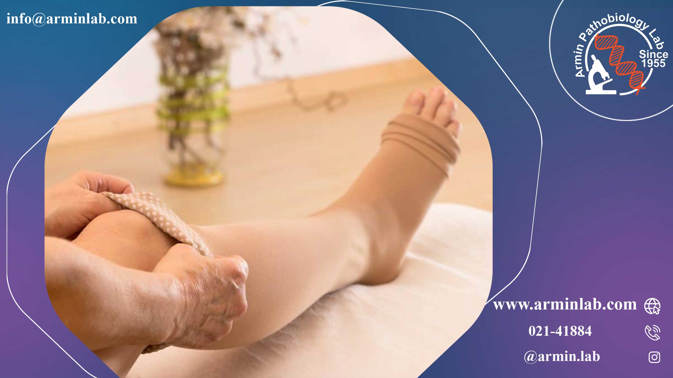 ترومبوز ورید عمقی (DVT) در بارداری  