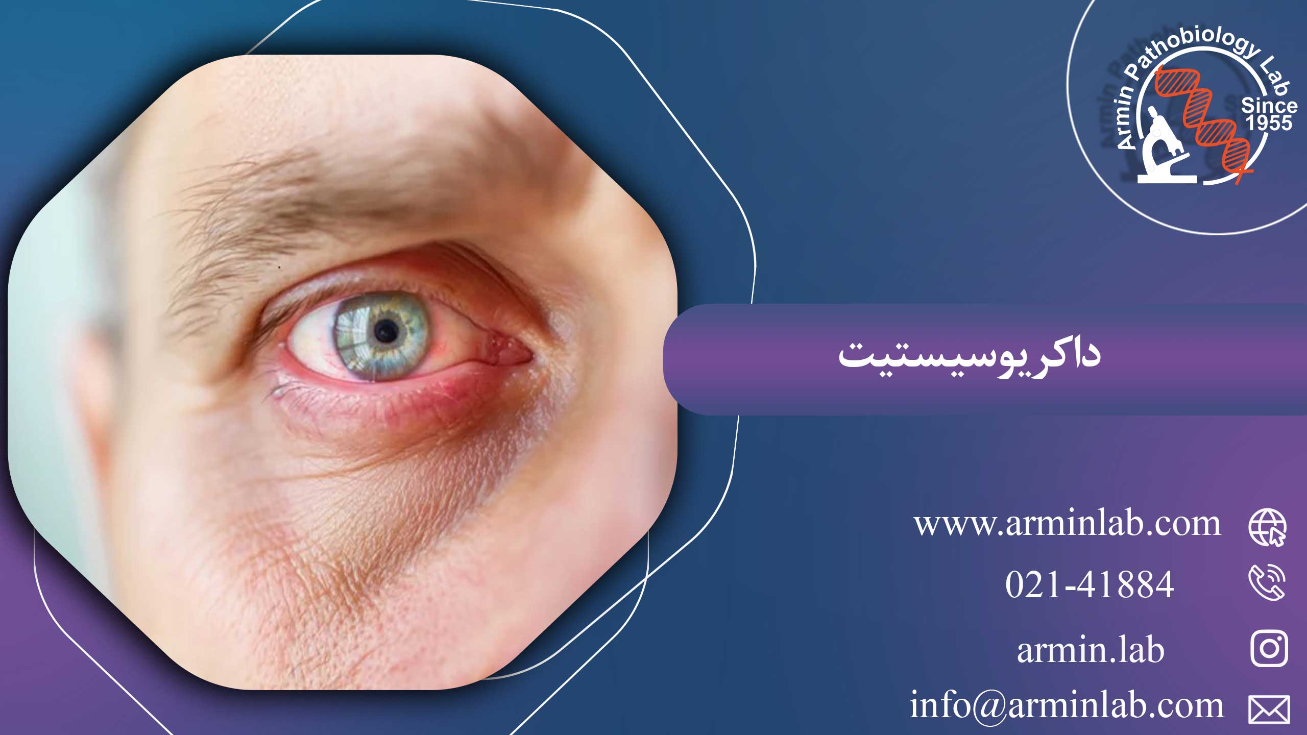 داکریوسیستیت