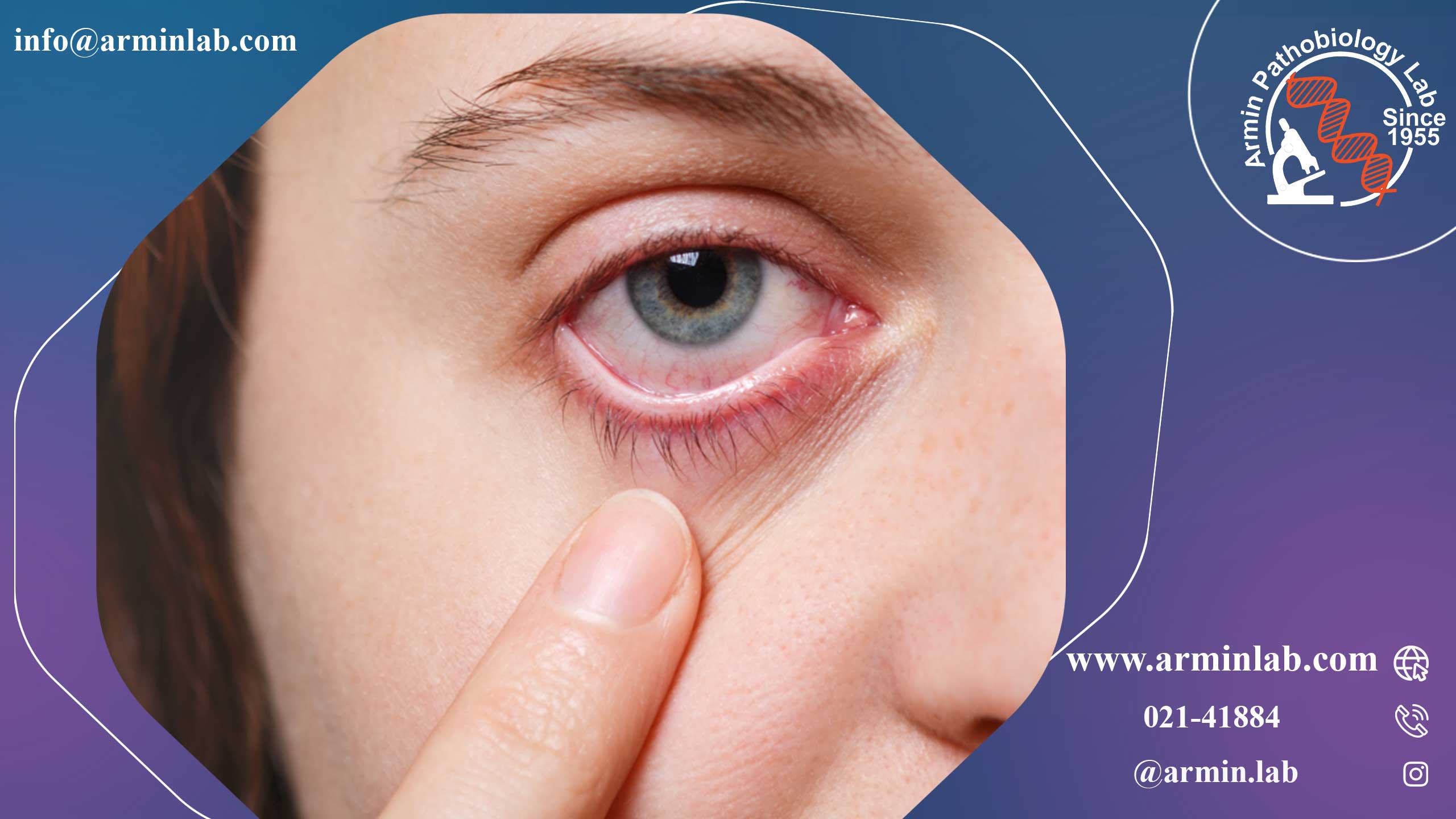 داکریوسیستیت