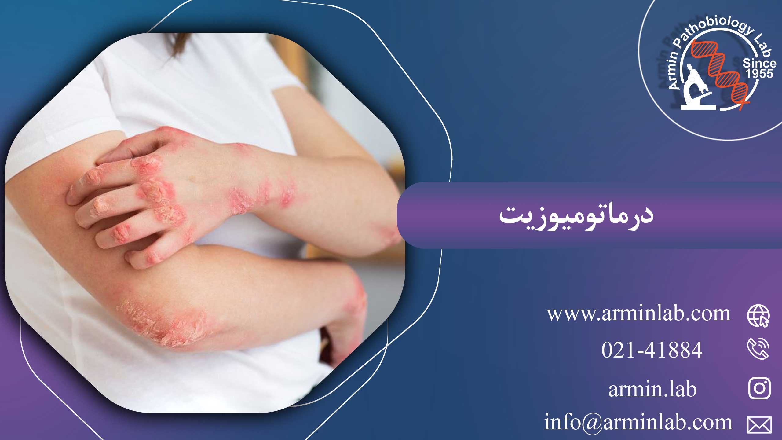 درماتومیوزیتarminlab1 درماتومیوزیت