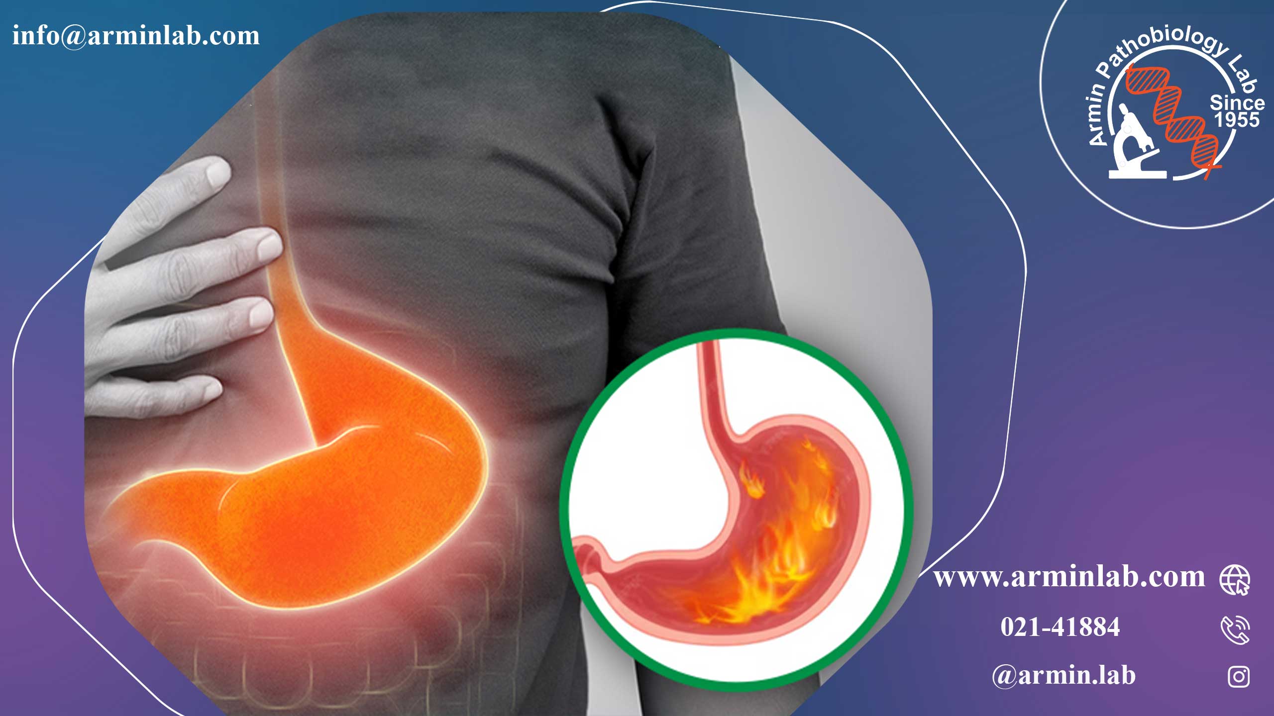 سندرم زولینگر-الیسون