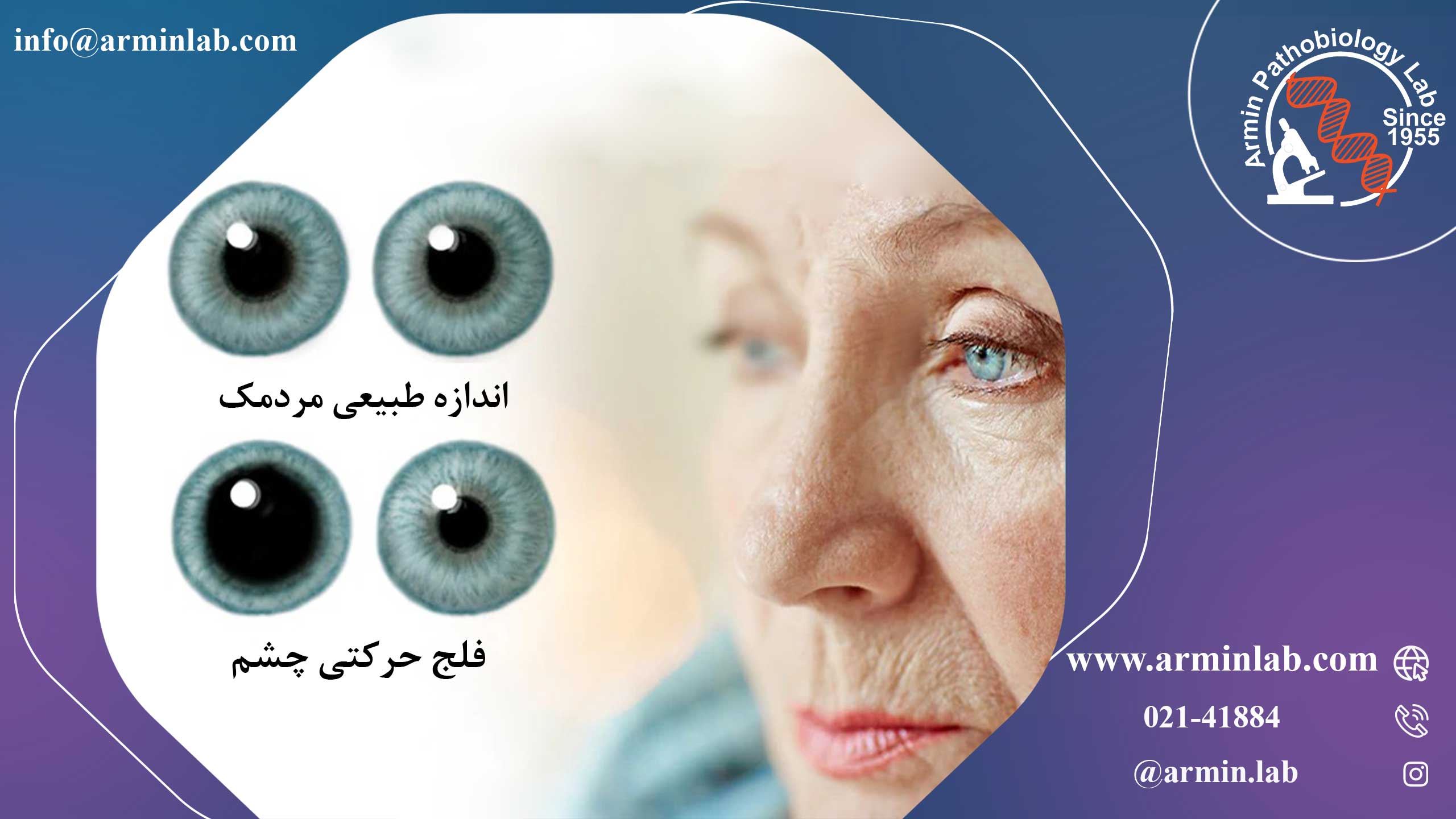 عصب حرکتی چشم (CN III)