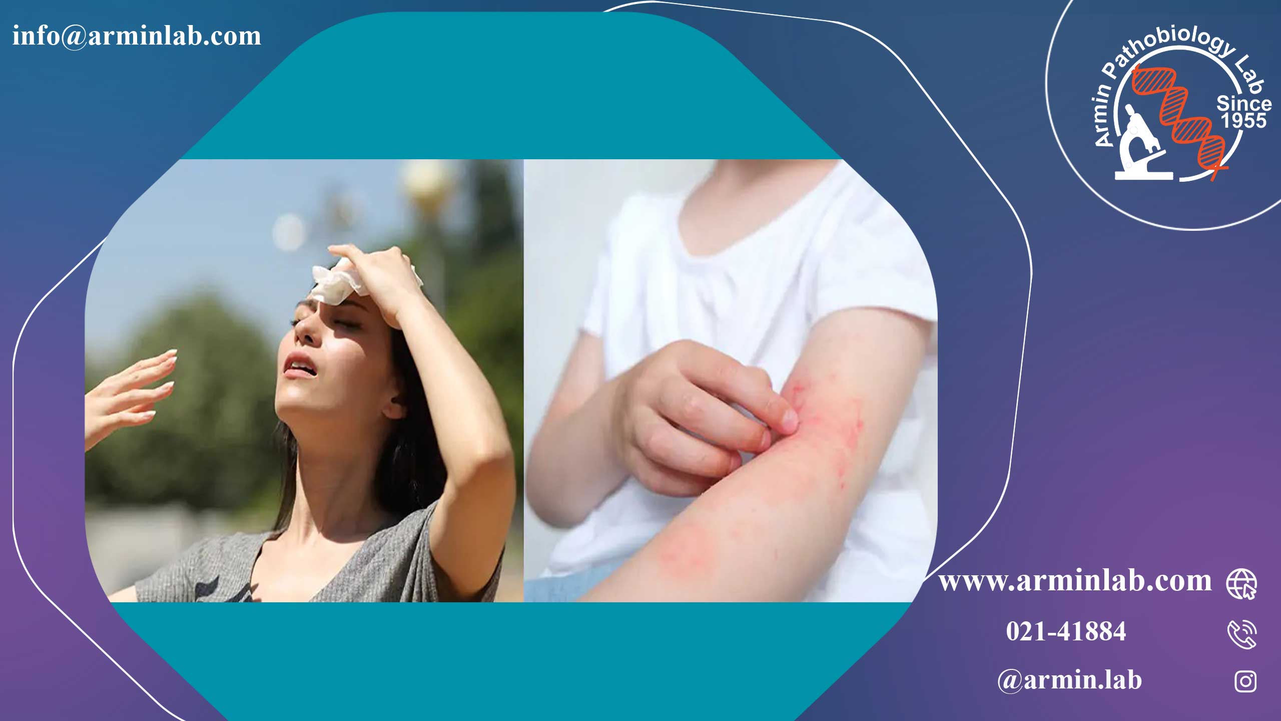 عفونت‌های قارچی صورت